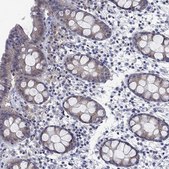 Anti-SULT2B1 antibody produced in rabbit Prestige Antibodies® Powered by Atlas Antibodies, affinity isolated antibody, buffered aqueous glycerol solution