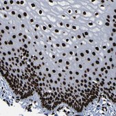 Anti-NPM1 antibody produced in rabbit Prestige Antibodies® Powered by Atlas Antibodies, affinity isolated antibody, buffered aqueous glycerol solution