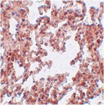 Anti-SRPX2 Antibody from rabbit, purified by affinity chromatography