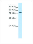 Anti-PRPF19 (AB2) antibody produced in rabbit IgG fraction of antiserum