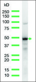 Anti-MUM1/IRF4 antibody, Rabbit monoclonal recombinant, expressed in proprietary host, clone SP114, affinity isolated antibody