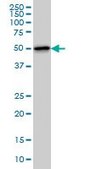 Monoclonal Anti-TTC8 antibody produced in mouse clone 700, purified immunoglobulin, buffered aqueous solution