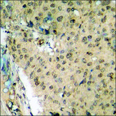 Anti-phospho-FHIT (pTyr114) antibody produced in rabbit affinity isolated antibody