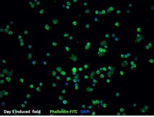 BLaER1 Human B-cell Precursor Leukemia Cell Line BLaER1 human B-cell precursor leukemia cell line may be transdifferentiated and used to model human monocytes.