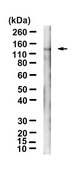 Anti-EphA2 Antibody, clone F2-27 ZooMAb® Mouse Monoclonal recombinant, expressed in HEK 293 cells