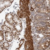Anti-SRGAP2 antibody produced in rabbit Prestige Antibodies® Powered by Atlas Antibodies, affinity isolated antibody, buffered aqueous glycerol solution, ab1