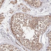 Anti-TYW3 antibody produced in rabbit Prestige Antibodies® Powered by Atlas Antibodies, affinity isolated antibody, buffered aqueous glycerol solution
