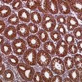Anti-LRRC57 antibody produced in rabbit Prestige Antibodies® Powered by Atlas Antibodies, affinity isolated antibody, buffered aqueous glycerol solution
