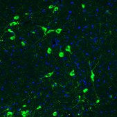 Monoclonal Anti-CHAT antibody produced in mouse Prestige Antibodies® Powered by Atlas Antibodies, clone CL3173, purified immunoglobulin, buffered aqueous glycerol solution