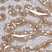 Anti-USH1C antibody produced in rabbit Prestige Antibodies® Powered by Atlas Antibodies, affinity isolated antibody, buffered aqueous glycerol solution, ab3