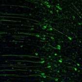 Anti-RAP1GAP antibody produced in rabbit Prestige Antibodies® Powered by Atlas Antibodies, affinity isolated antibody, buffered aqueous glycerol solution