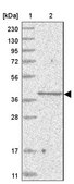 Anti-SLC35A5 antibody produced in rabbit Prestige Antibodies® Powered by Atlas Antibodies, affinity isolated antibody, buffered aqueous glycerol solution