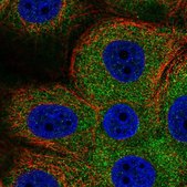Anti-PHKG2 antibody produced in rabbit Prestige Antibodies® Powered by Atlas Antibodies, affinity isolated antibody