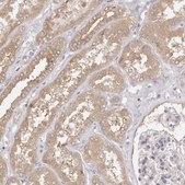 Anti-EEF1E1 antibody produced in rabbit Prestige Antibodies® Powered by Atlas Antibodies, affinity isolated antibody, buffered aqueous glycerol solution