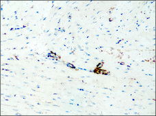 Anti-Destrin/ADF (GV-13) antibody produced in rabbit affinity isolated antibody, buffered aqueous solution