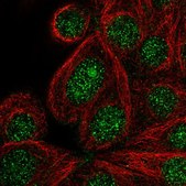 Anti-DENND2C antibody produced in rabbit Prestige Antibodies® Powered by Atlas Antibodies, affinity isolated antibody, buffered aqueous glycerol solution