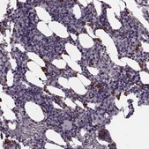 Anti-CST7 antibody produced in rabbit Prestige Antibodies® Powered by Atlas Antibodies, affinity isolated antibody, buffered aqueous glycerol solution