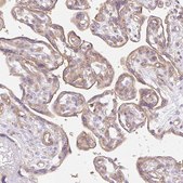 Anti-EHD3 antibody produced in rabbit Prestige Antibodies® Powered by Atlas Antibodies, affinity isolated antibody, buffered aqueous glycerol solution