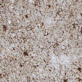 Anti-ARMC10 antibody produced in rabbit Ab2, Prestige Antibodies® Powered by Atlas Antibodies, affinity isolated antibody, buffered aqueous glycerol solution