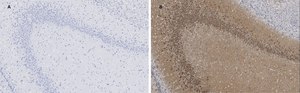 Anti-GluR2 Antibody, clone 1K4, ZooMAb® Rabbit Monoclonal recombinant, expressed in HEK 293 cells
