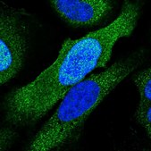 Anti-PSMC6 antibody produced in rabbit Prestige Antibodies® Powered by Atlas Antibodies, affinity isolated antibody, buffered aqueous glycerol solution
