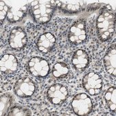 Anti-ELOA antibody produced in rabbit Prestige Antibodies® Powered by Atlas Antibodies, affinity isolated antibody, buffered aqueous glycerol solution