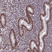 Anti-TTF1 antibody produced in rabbit Prestige Antibodies® Powered by Atlas Antibodies, affinity isolated antibody, buffered aqueous glycerol solution