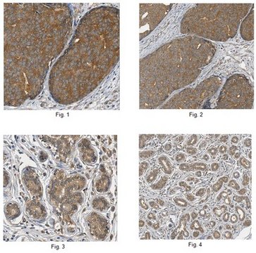 Anti-FAM60A Antibody from rabbit, purified by affinity chromatography
