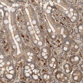 Anti-ASPSCR1 antibody produced in rabbit Prestige Antibodies® Powered by Atlas Antibodies, affinity isolated antibody, buffered aqueous glycerol solution