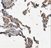 Anti-SnoN Antibody from rabbit, purified by affinity chromatography
