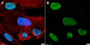Anti-RAN Antibody, clone 1D6 ZooMAb® Rabbit Monoclonal recombinant, expressed in HEK 293 cells