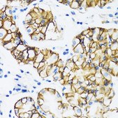 Anti- α-Catenin antibody produced in rabbit