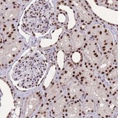 Anti-PRPF19 antibody produced in rabbit Prestige Antibodies® Powered by Atlas Antibodies, affinity isolated antibody, buffered aqueous glycerol solution