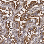 Anti-C19orf12 antibody produced in rabbit Prestige Antibodies® Powered by Atlas Antibodies, affinity isolated antibody, buffered aqueous glycerol solution