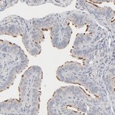 Anti-JAM3 antibody produced in rabbit Prestige Antibodies® Powered by Atlas Antibodies, affinity isolated antibody, buffered aqueous glycerol solution