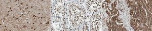 Anti-SMARCD2 (BAF60B) from rabbit, purified by affinity chromatography