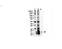 Anti-C9ORF72/C9RANT (Poly-PR) serum, from rabbit