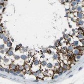 Anti-CYB5R1 antibody produced in rabbit Prestige Antibodies® Powered by Atlas Antibodies, affinity isolated antibody, buffered aqueous glycerol solution