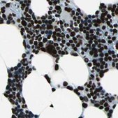 Anti-BCLAF1 antibody produced in rabbit Prestige Antibodies® Powered by Atlas Antibodies, affinity isolated antibody, buffered aqueous glycerol solution