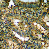 Anti-phospho-AXL (pTyr698) antibody produced in rabbit affinity isolated antibody