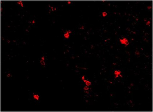 Anti-FEZ2 Antibody from rabbit, purified by affinity chromatography