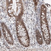 Anti-SNRNP200 antibody produced in rabbit Prestige Antibodies® Powered by Atlas Antibodies, affinity isolated antibody, buffered aqueous glycerol solution