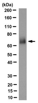 Anti- LTP/CETP Antibody, clone 3-11D clone 3-11D, from mouse