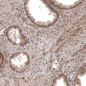 Monoclonal Anti-CDK4 antibody produced in mouse Prestige Antibodies® Powered by Atlas Antibodies, clone CL8102, purified immunoglobulin, buffered aqueous glycerol solution