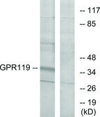 Anti-GPR119 antibody produced in rabbit affinity isolated antibody