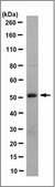 Anti-Wilms′ Tumor Antibody, NT clone 6F-H2, Ascites Free clone 6F-H2, from mouse