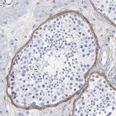 Anti-EMILIN1 antibody produced in rabbit Prestige Antibodies® Powered by Atlas Antibodies, affinity isolated antibody, buffered aqueous glycerol solution