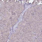 Anti-CFL2 antibody produced in rabbit Prestige Antibodies® Powered by Atlas Antibodies, affinity isolated antibody, buffered aqueous glycerol solution
