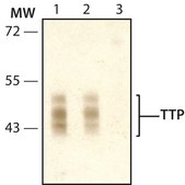 Anti-TTP (N-terminal) antibody produced in rabbit ~1.0 mg/mL, affinity isolated antibody, buffered aqueous solution