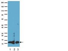 Anti-S-100 Protein Antibody, clone 15E2E2 clone 15E2E2, Chemicon®, from mouse